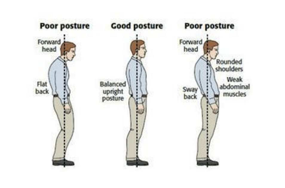 이미지 출처 : http://www.thephysiocompany.com/blog/stop-slouching-postural-dysfunction-symptoms-causes-and-treatment-of-bad-posture