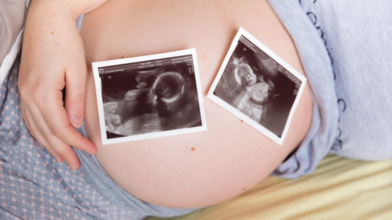 쌍둥이로 임신 할 위험이 사라진다.