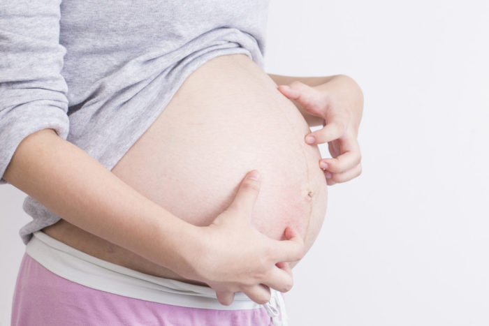 Pruritic folliculitis는 임신 동안 가려운 피부의 원인입니다